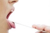 Bệnh giang mai ở lưỡi và cách phòng tránh hiệu quả