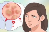 Cách nhận biết triệu chứng và dấu hiệu viêm âm đạo
