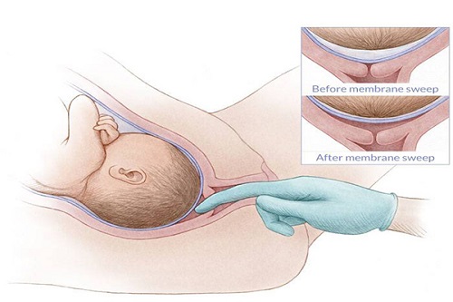 Khám Cổ Tử Cung Lọt 1 Ngón Tay: Những Điều Cần Biết và Lợi Ích Quan Trọng